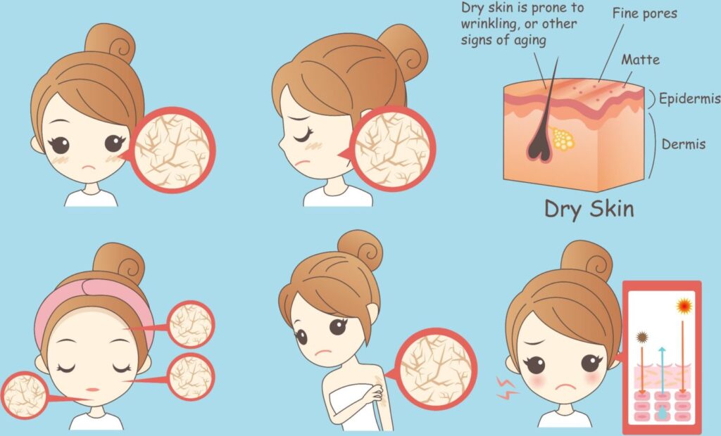 woman face dry skin, Healthy Lifestyle Concept